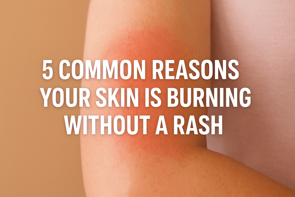 Your Skin Is Burning Without a Rash