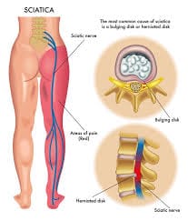 sciatic nerve