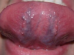 tongue blood supply